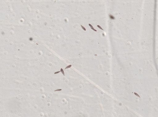 Opalina