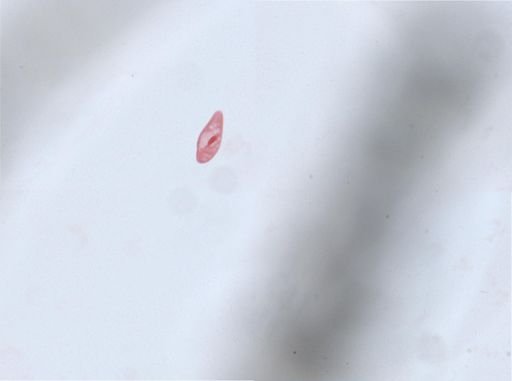 Paramecium aurelia