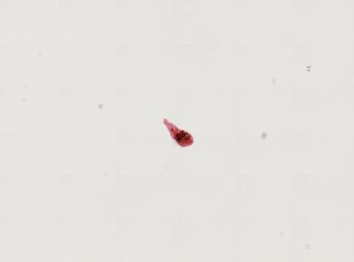Ascocotyle sp.