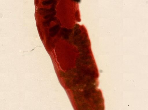 Platyhelminthes