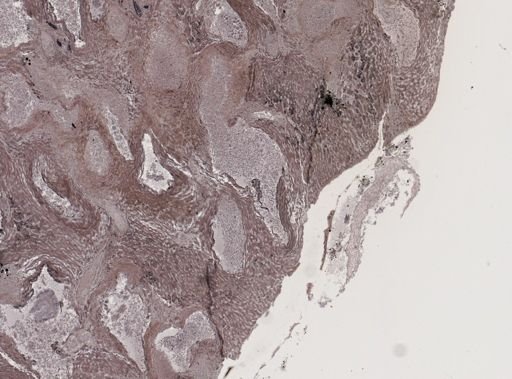 Taenia taeniaeformis
