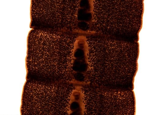 Diphyllobothrium erinacei