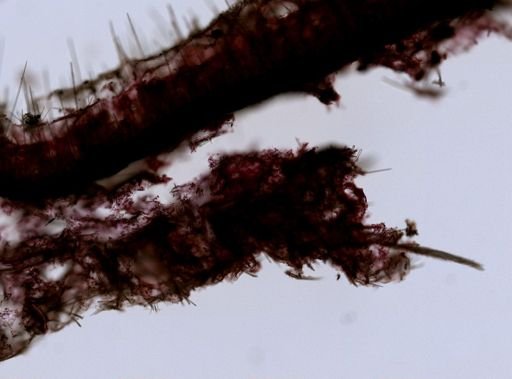 Tedania suctoria