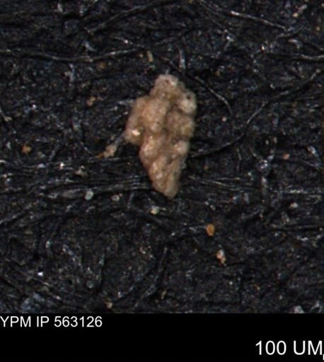 Verneuilina canadensis