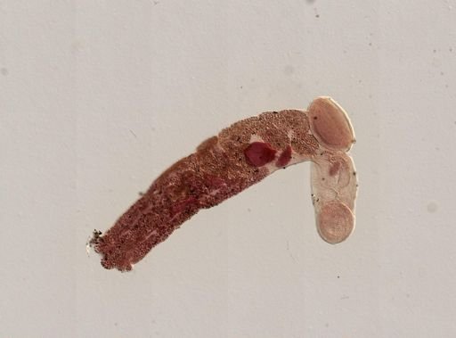 Platyhelminthes