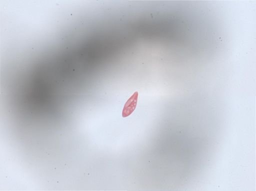 Paramecium aurelia
