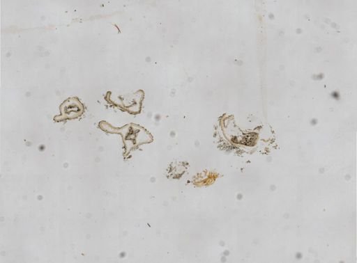 Pherusella