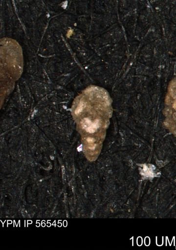 Verneuilina canadensis