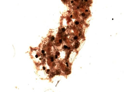 Dendrobeania lichenoides