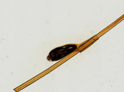 Pthirus pubis