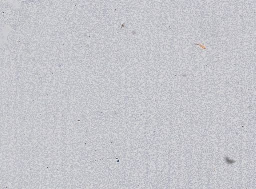 Plasmodium vivax