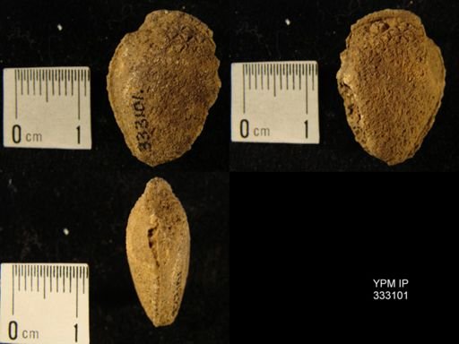 Amygdalocystites?