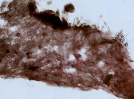 cf. Axinellidae
