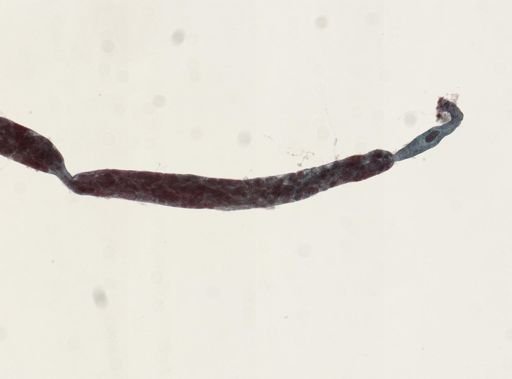 Trematoda
