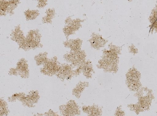 Stromatospongia micronesica