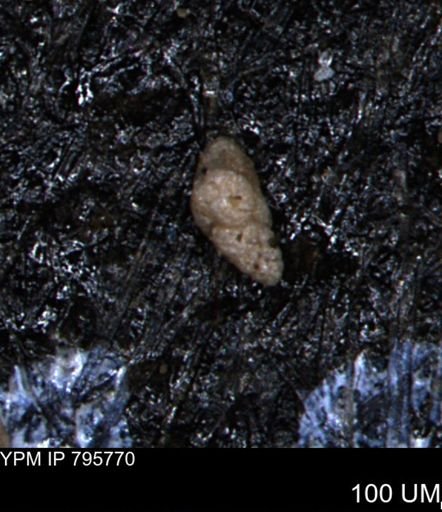 Verneuilina canadensis