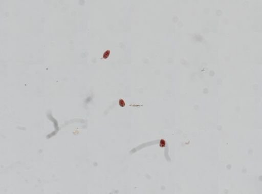 Trematoda