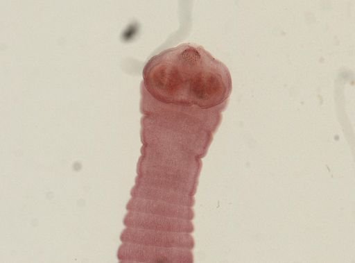 Dipylidium caninum