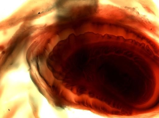 Taenia solium