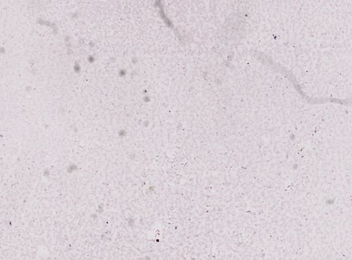 Trypanosoma brucei rhodesiense