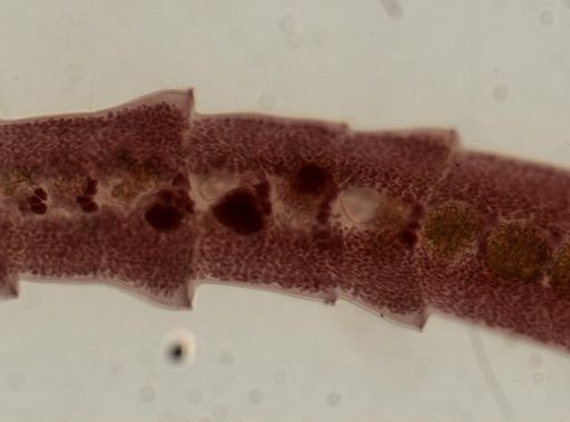 Eucestoda