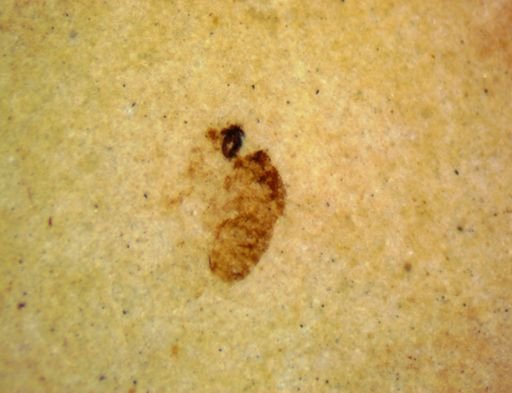 undet. Diptera