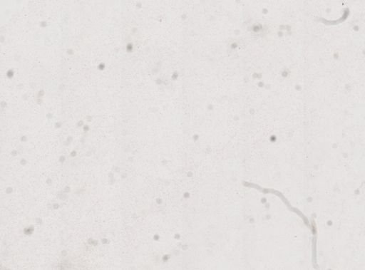 Trypanosoma brucei gambiense