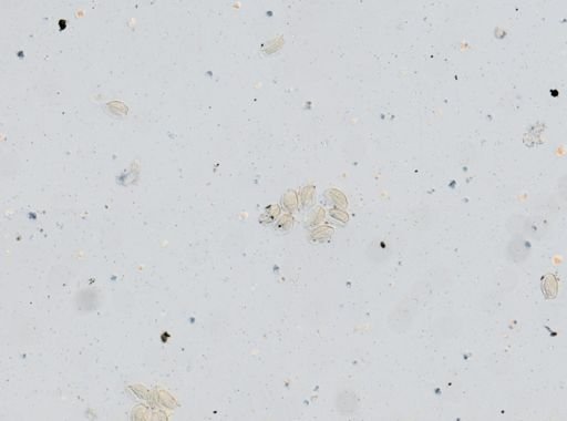 Ascaris lumbricoides