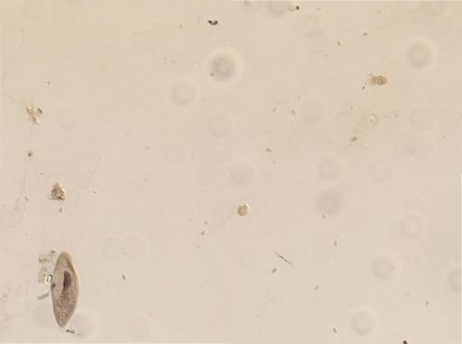 Amoeba