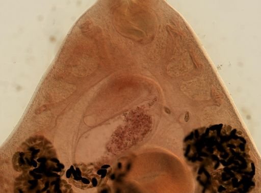 Fasciola hepatica