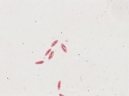 Paramecium calkinsi
