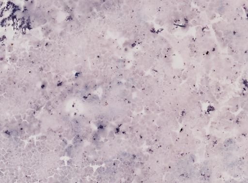 Leishmania donovani