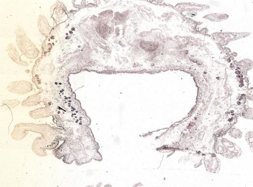 Thysanozoon brocchii