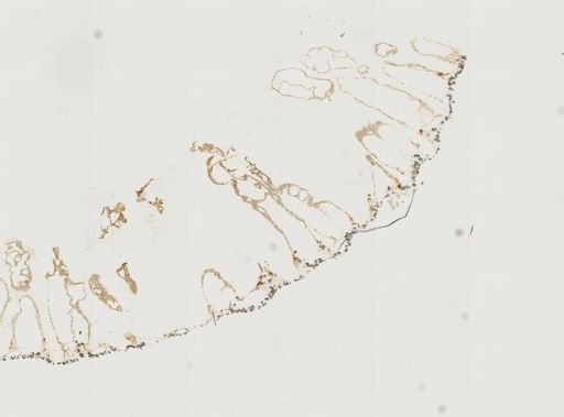 Acanthochaetetes wellsi