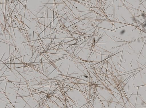 Suberites aurantiacus