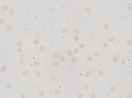 Toxocara cati