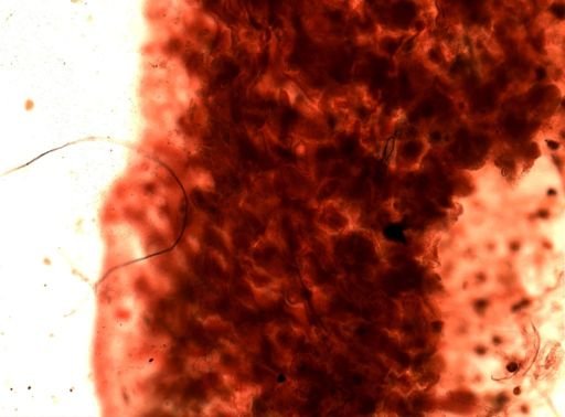 Alcyonidium
