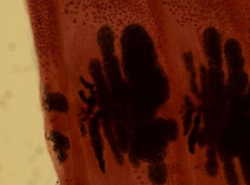 Diphyllobothrium latum