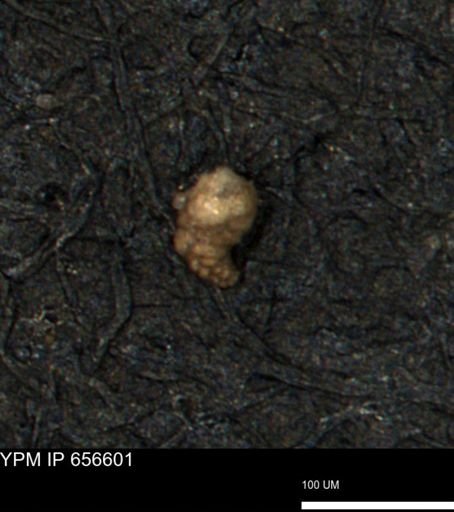 Verneuilina canadensis