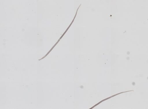 Trichinella spiralis