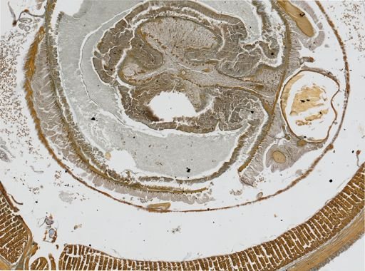 Lumbricus terrestris