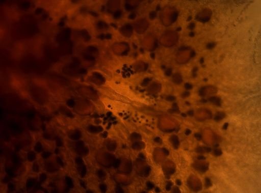 Pleioplana atomata