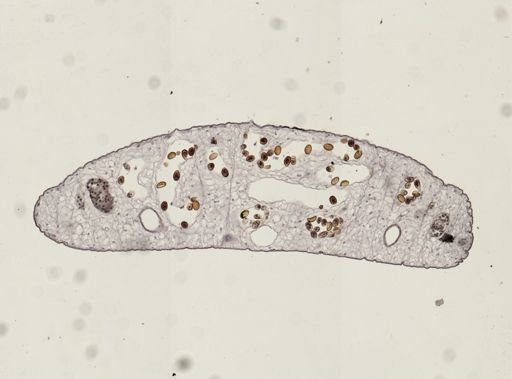Dicrocoelium dendriticum
