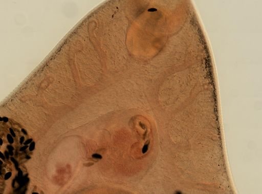 Fasciola hepatica