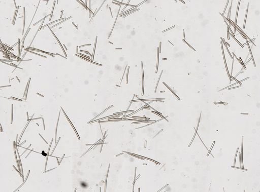 Axinella sp.