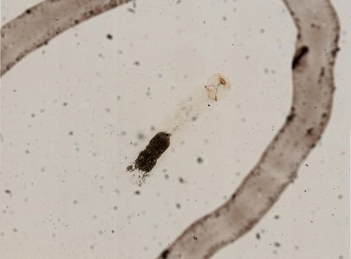 Polypedilum