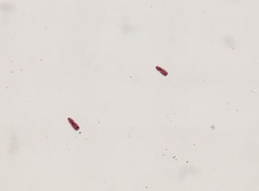 Fasciola hepatica