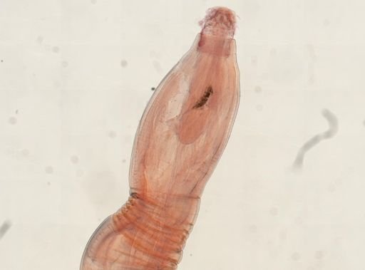 Oligacanthorhynchus microcephalus