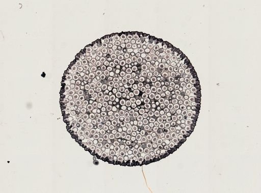 Ascaris