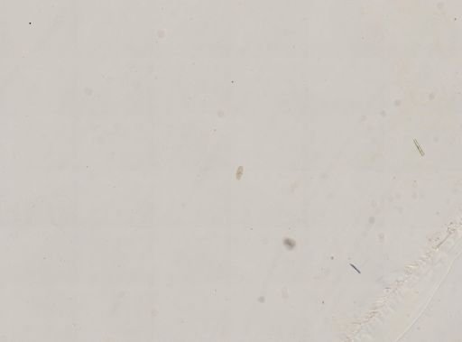 Paramecium